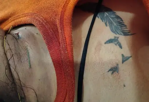 Sheetal Murder Case :  गर्दन पर चाकू के घाव।